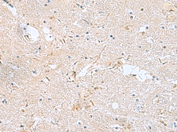 Immunohistochemistry of paraffin-embedded Human brain tissue  using FAM107B Polyclonal Antibody at dilution of 1:160(×200)
