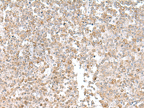 Immunohistochemistry of paraffin-embedded Human tonsil tissue  using EIF1AY Polyclonal Antibody at dilution of 1:55(×200)