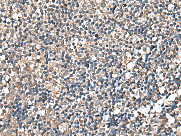 Immunohistochemistry of paraffin-embedded Human tonsil tissue  using RPS14 Polyclonal Antibody at dilution of 1:60(×200)