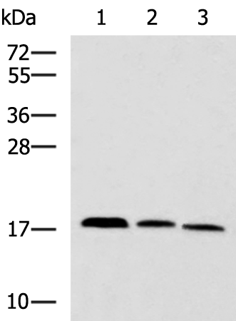 Western blot analysis of Mouse kidney tissue Rat brain tissue Mouse liver tissue lysates  using CPLX3 Polyclonal Antibody at dilution of 1:950