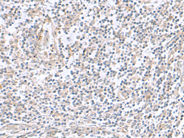 Immunohistochemistry of paraffin-embedded Human tonsil tissue  using TNNC2 Polyclonal Antibody at dilution of 1:50(×200)