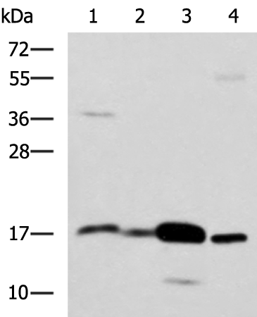 Western blot analysis of Mouse Pancreas tissue Mouse small intestines tissue Mouse large intestine tissue Human sigmoid tissue lysates  using ZG16 Polyclonal Antibody at dilution of 1:1350