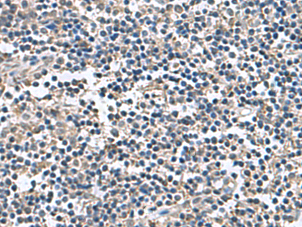 Immunohistochemistry of paraffin-embedded Human tonsil tissue  using BLOC1S6 Polyclonal Antibody at dilution of 1:60(×200)