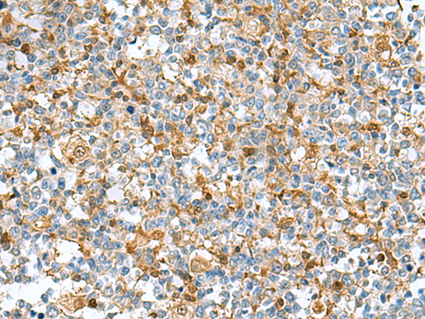 Immunohistochemistry of paraffin-embedded Human tonsil tissue  using DNPH1 Polyclonal Antibody at dilution of 1:55(×200)