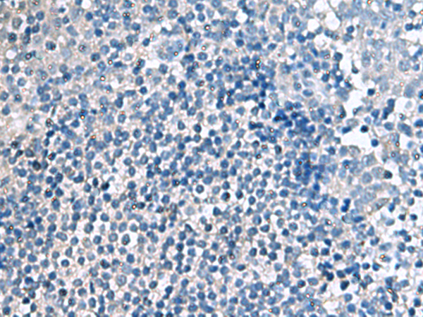 Immunohistochemistry of paraffin-embedded Human tonsil tissue  using EIF4A2 Polyclonal Antibody at dilution of 1:70(×200)