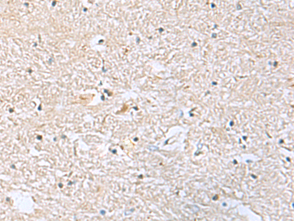 Immunohistochemistry of paraffin-embedded Human brain tissue  using EIF4A2 Polyclonal Antibody at dilution of 1:70(×200)