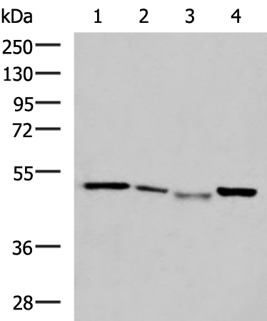 Western blot analysis of HepG2 cell Hela cell Mouse kidney tissue K562 cell lysates  using NFS1 Polyclonal Antibody at dilution of 1:800