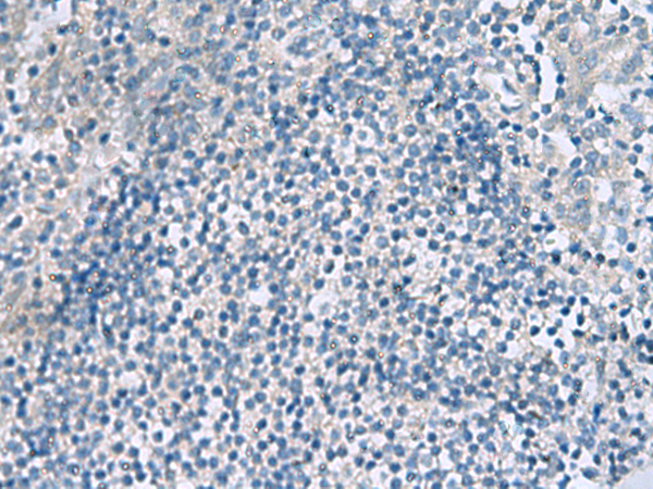 Immunohistochemistry of paraffin-embedded Human tonsil tissue  using HPCAL1 Polyclonal Antibody at dilution of 1:90(×200)