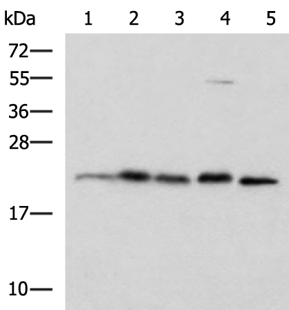 Western blot analysis of A172 HepG2 Hela cell Rat brain tissue and Mouse brain tissue lysates  using HPCAL1 Polyclonal Antibody at dilution of 1:1250