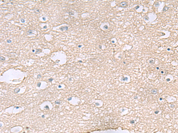 Immunohistochemistry of paraffin-embedded Human brain tissue  using TAGLN3 Polyclonal Antibody at dilution of 1:60(×200)