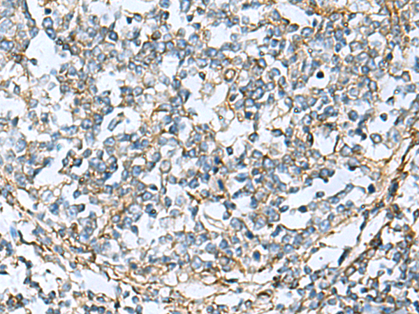 Immunohistochemistry of paraffin-embedded Human tonsil tissue  using CLTB Polyclonal Antibody at dilution of 1:60(×200)