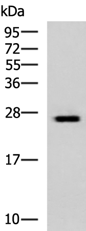 Western blot analysis of Hela cell lysate  using GINS3 Polyclonal Antibody at dilution of 1:800