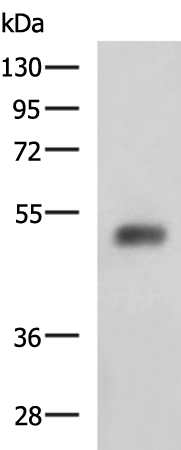 Western blot analysis of Human bladder transitional cell carcinoma grade 2-3 tissue lysate  using SLC30A6 Polyclonal Antibody at dilution of 1:2000