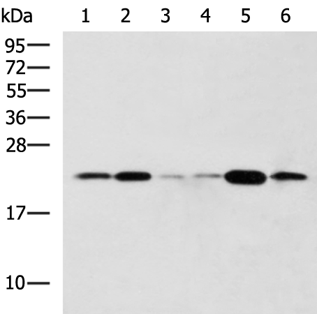 Western blot analysis of Raji Hela cell Mouse liver tissue Rat lung tissue Mouse Pancreas tissue NIH/3T3 cell lysates  using TMED10 Polyclonal Antibody at dilution of 1:800