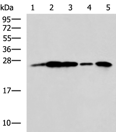 Western blot analysis of A549 cell Rat brain tissue Mouse brain tissue A172 cell Human cerebrum tissue lysates  using UCHL1 Polyclonal Antibody at dilution of 1:800