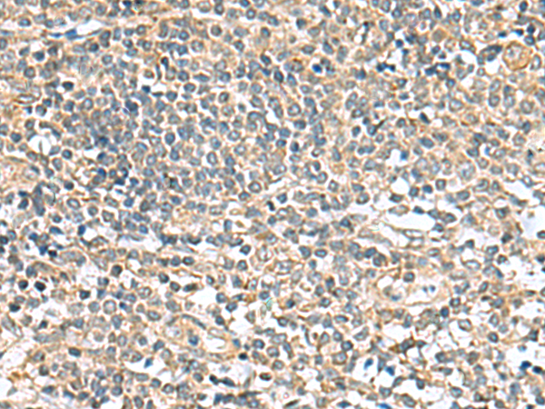 Immunohistochemistry of paraffin-embedded Human tonsil tissue  using CCDC134 Polyclonal Antibody at dilution of 1:50(×200)