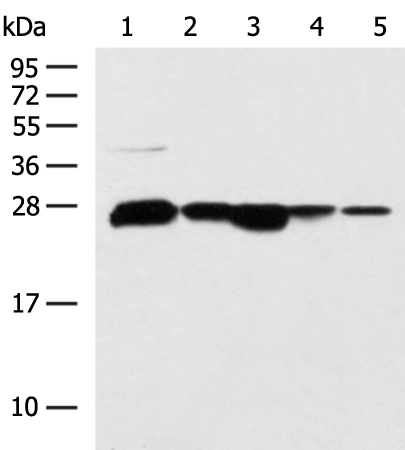 Western blot analysis of 293T HepG2 cell Human fetal liver tissue Human liver tissue TM4 cell lysates  using CCDC134 Polyclonal Antibody at dilution of 1:800