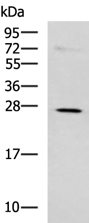 Western blot analysis of K562 cell lysate  using NQO2 Polyclonal Antibody at dilution of 1:650