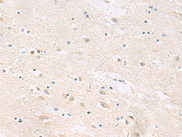 Immunohistochemistry of paraffin-embedded Human brain tissue  using ANKS6 Polyclonal Antibody at dilution of 1:55(×200)