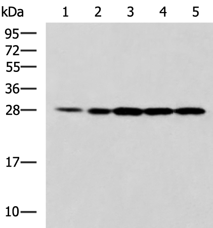 Western blot analysis of 293T Jurkat and A375 cell lysates  using PSMA6 Polyclonal Antibody at dilution of 1:900