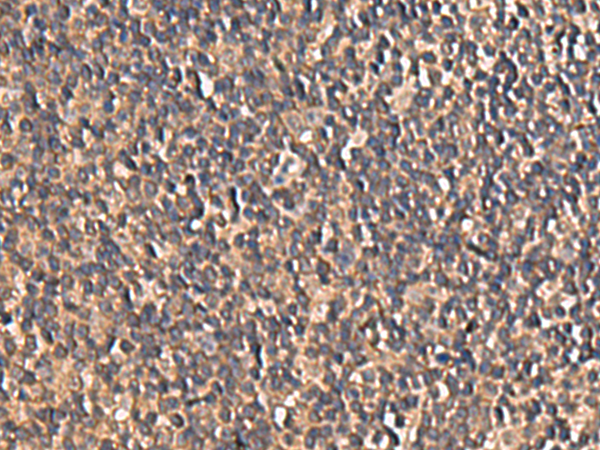 Immunohistochemistry of paraffin-embedded Human tonsil tissue  using PLEKHF2 Polyclonal Antibody at dilution of 1:85(×200)