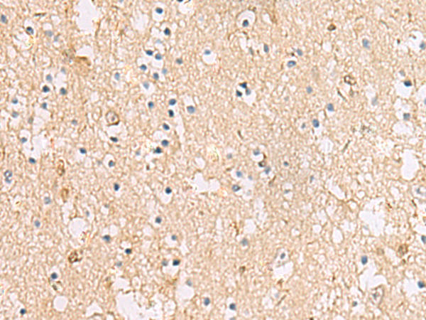 Immunohistochemistry of paraffin-embedded Human brain tissue  using PLEKHF2 Polyclonal Antibody at dilution of 1:85(×200)