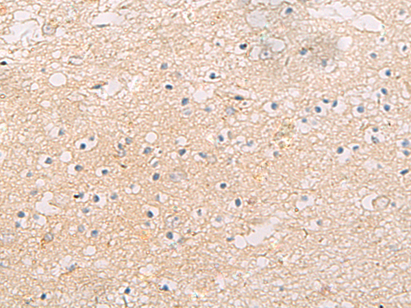 Immunohistochemistry of paraffin-embedded Human brain tissue  using FYCO1 Polyclonal Antibody at dilution of 1:60(×200)