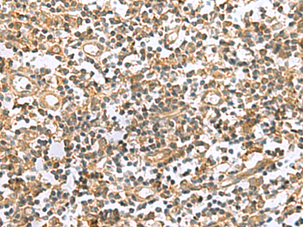 Immunohistochemistry of paraffin-embedded Human tonsil tissue  using HHIPL2 Polyclonal Antibody at dilution of 1:50(×200)