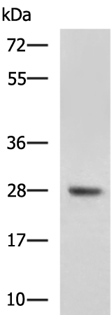 Western blot analysis of Mouse liver tissue lysate  using DHRS2 Polyclonal Antibody at dilution of 1:800