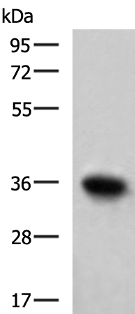 Western blot analysis of Mouse skeletal muscle tissue lysate  using TNNT1 Polyclonal Antibody at dilution of 1:550