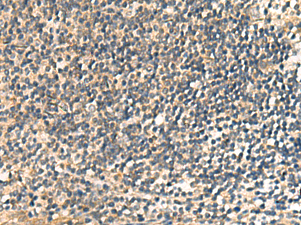 Immunohistochemistry of paraffin-embedded Human tonsil tissue  using CNST Polyclonal Antibody at dilution of 1:60(×200)