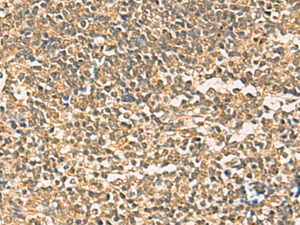 Immunohistochemistry of paraffin-embedded Human tonsil tissue  using THG1L Polyclonal Antibody at dilution of 1:50(×200)