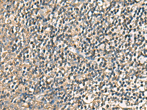 Immunohistochemistry of paraffin-embedded Human tonsil tissue  using VTA1 Polyclonal Antibody at dilution of 1:85(×200)