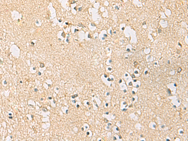 Immunohistochemistry of paraffin-embedded Human brain tissue  using PDE4DIP Polyclonal Antibody at dilution of 1:45(×200)