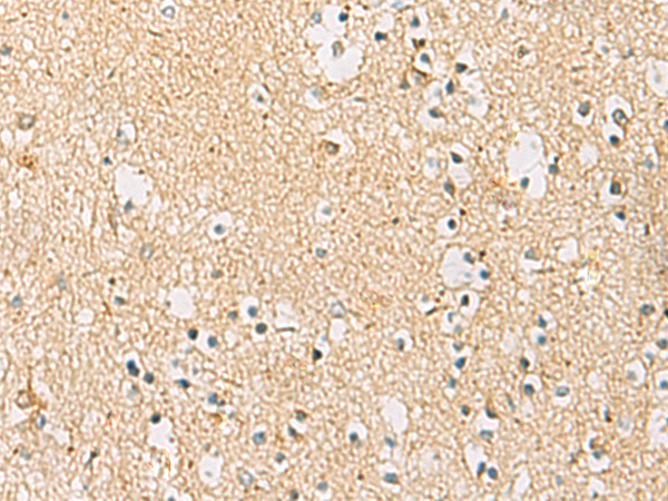 Immunohistochemistry of paraffin-embedded Human brain tissue  using IDS Polyclonal Antibody at dilution of 1:70(×200)