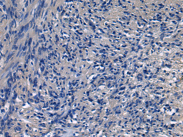 Immunohistochemistry of paraffin-embedded Human brain tissue  using ICA1 Polyclonal Antibody at dilution of 1:50(×200)