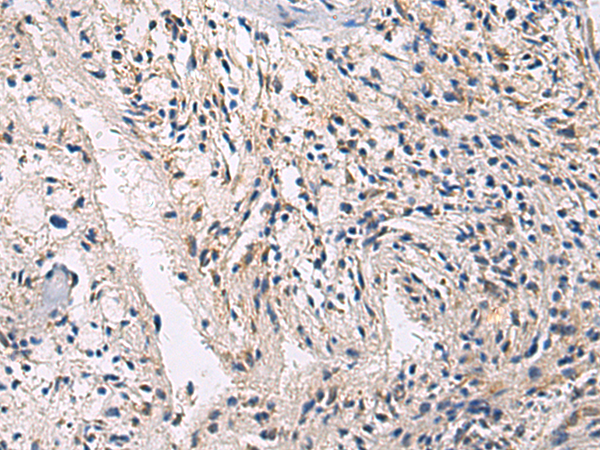 Immunohistochemistry of paraffin-embedded Human brain tissue  using CEP89 Polyclonal Antibody at dilution of 1:100(×200)