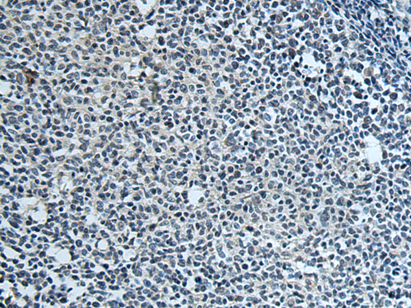 Immunohistochemistry of paraffin-embedded Human tonsil tissue  using FCRLA Polyclonal Antibody at dilution of 1:80(×200)