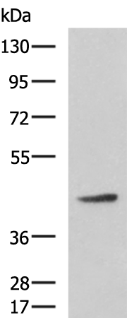 Western blot analysis of Hela cell lysate  using ARPC1B Polyclonal Antibody at dilution of 1:800