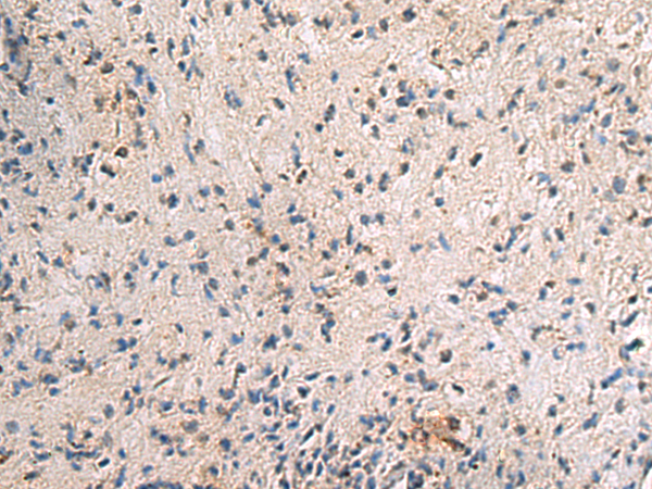Immunohistochemistry of paraffin-embedded Human brain tissue  using PA2G4 Polyclonal Antibody at dilution of 1:60(×200)