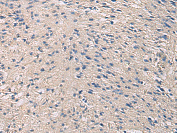 Immunohistochemistry of paraffin-embedded Human brain tissue  using PRKCSH Polyclonal Antibody at dilution of 1:90(×200)