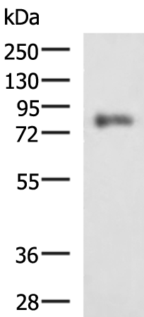 Western blot analysis of HepG2 cell lysate  using PRKCSH Polyclonal Antibody at dilution of 1:1350