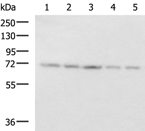 Western blot analysis of 293T PC3 cell Mouse liver tissue and Mouse kidney tissue lysates  using PAIP1 Polyclonal Antibody at dilution of 1:800