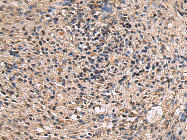 Immunohistochemistry of paraffin-embedded Human brain tissue  using ITIH2 Polyclonal Antibody at dilution of 1:70(×200)