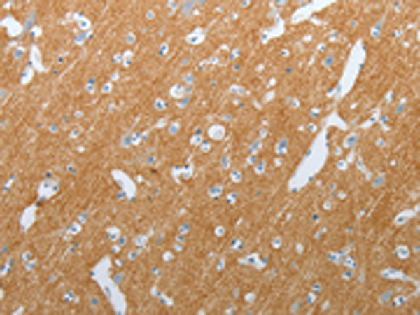 Immunohistochemistry of paraffin-embedded Human brain tissue  using SLC17A7 Polyclonal Antibody at dilution of 1:200(×200)