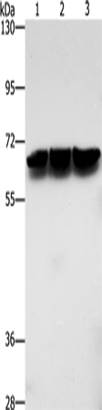 Western blot analysis of Jurkat cells hela cells mouse brain tissue  using ZBTB1  Polyclonal Antibody at dilution of 1:500