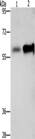 Western blot analysis of Hepg2 cells NIH/3T3 cells  using ZBTB7A  Polyclonal Antibody at dilution of 1:500