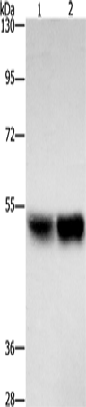 Western blot analysis of Hela cells A431 cells  using ZFYVE19  Polyclonal Antibody at dilution of 1:500