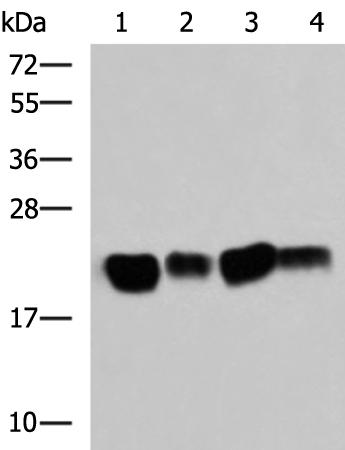 Western blot analysis of Mouse brain tissue SKOV3 cell Rat brain tissue Mouse kidney tissue lysates  using HRAS Polyclonal Antibody at dilution of 1:500