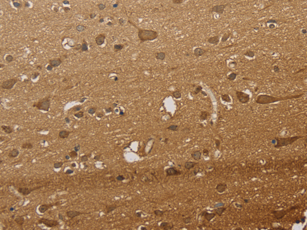 Immunohistochemistry of paraffin-embedded Human brain tissue  using CSNK2B Polyclonal Antibody at dilution of 1:30(×200)